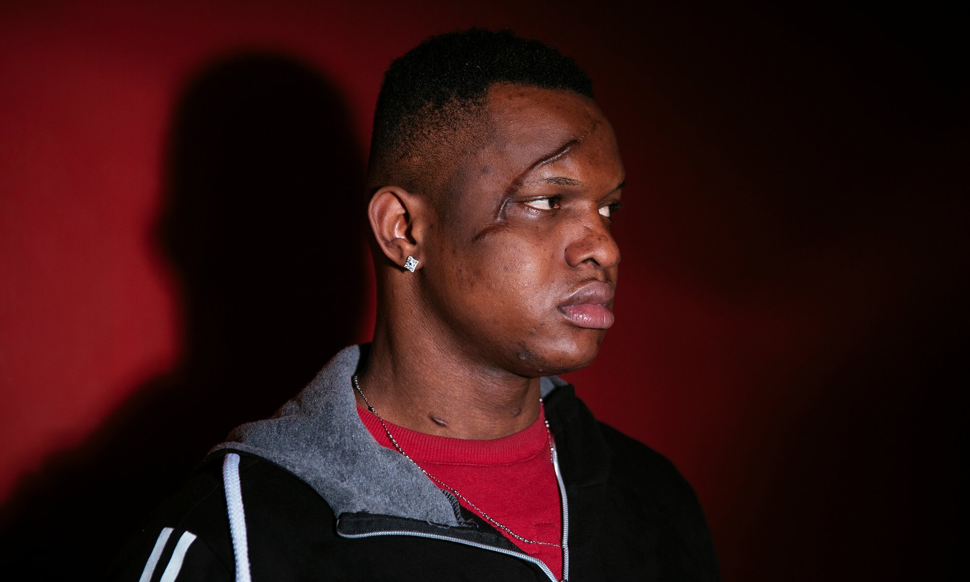 Emmanuel, a 25 year-old Nigerian living in Palermo, claims his face was scarred with a machete by members of the Black Axe clan. Photograph: Francesco Bellina